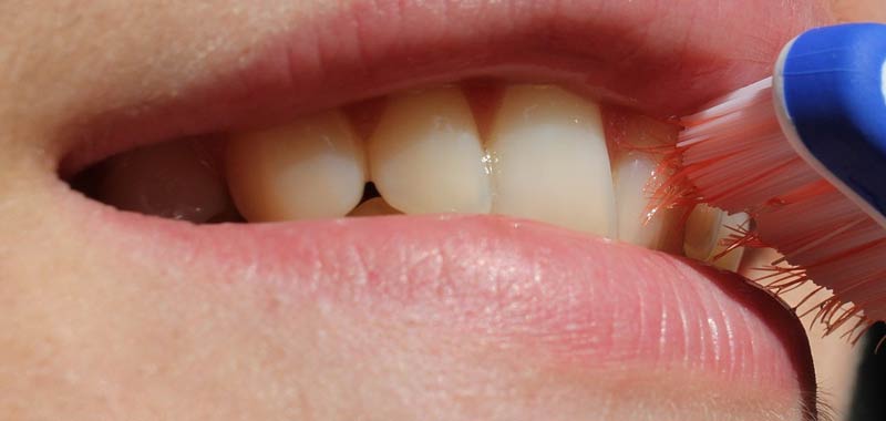 Pulizia dei denti ogni quanto consigliabile farla