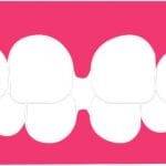 Gengive gonfie ecco come curarle in modo naturale