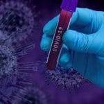 Apocalisse La bestia la tecnologia e il vaccino anti covid