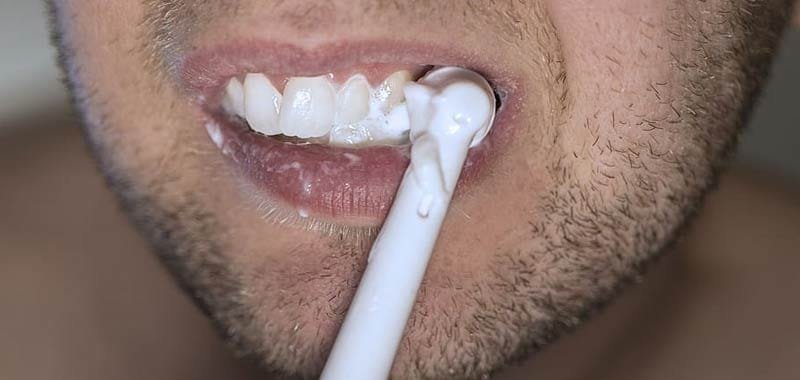 Perdita di denti effetto a lungo termine del coronavirus