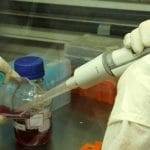 Immunoterapia utile per il melanoma avanzato