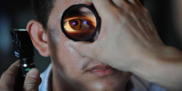 Glaucoma: Alta pressione oculare può portare alla cecità