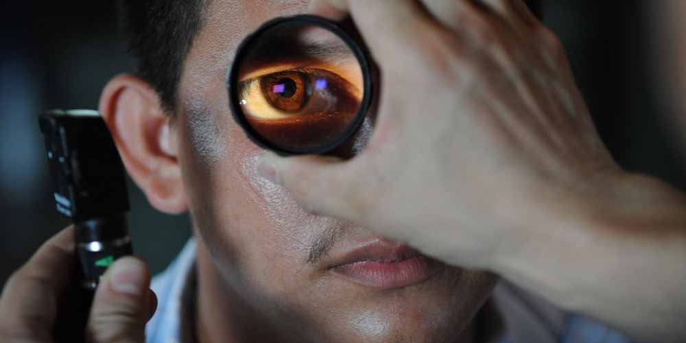 Glaucoma Alta pressione oculare puo portare alla cecita