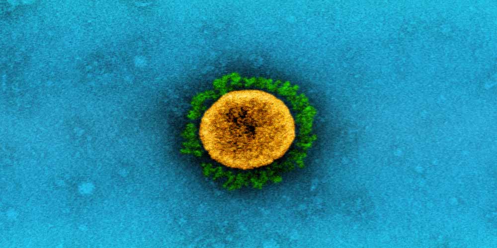 Delta Plus Quali sono i pericoli del ceppo coronavirus indiano
