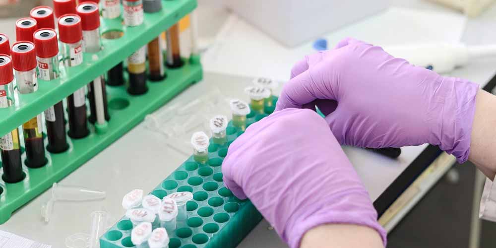 Ulteriori prove confermano Coronavirus creato in laboratorio