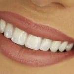 Un semplice modo per tenere puliti i denti