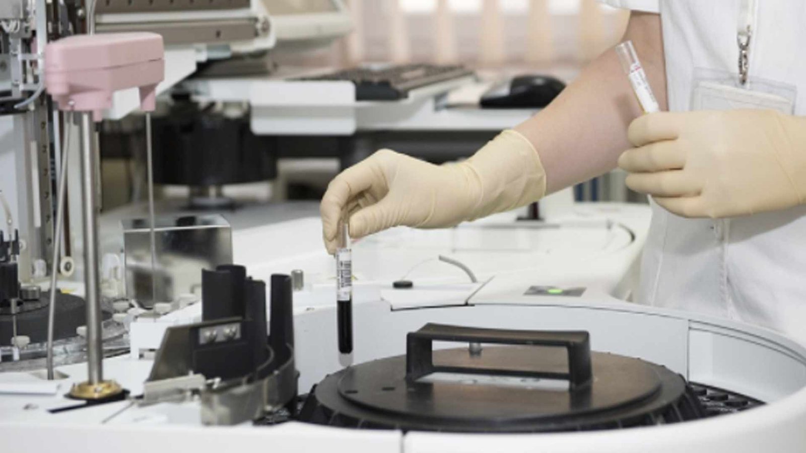 Uomo cinese si costruisce un laboratorio in casa per salvare suo figlio