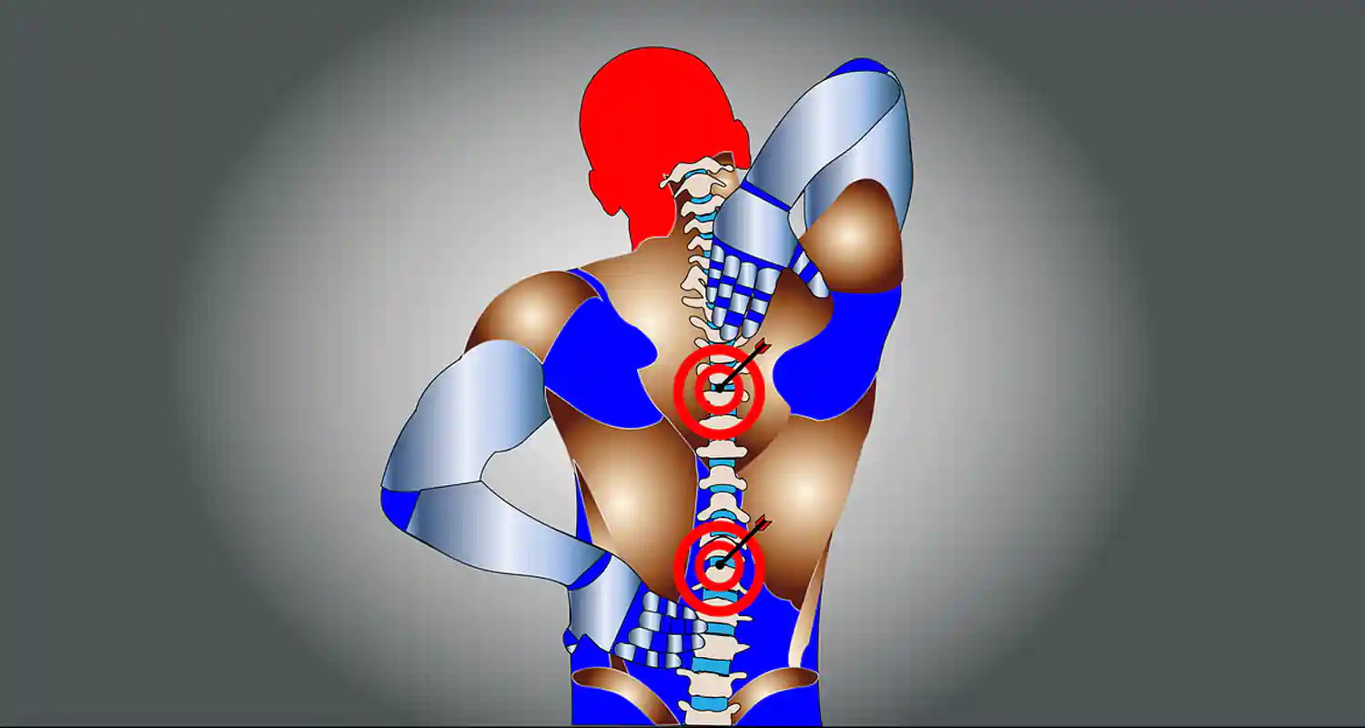 Come correggere la postura consigli