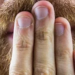 Sai che cosa puo indicare anche il singhiozzo