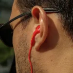 Acufene Ma davvero non ci sono rimedi