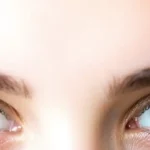 Colpita da un fulmine cambia il colore degli occhi