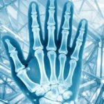 perche-alcune-persone-non-si-rompono-mai-ossa-scienza-genetica