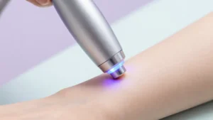 guida-depilazione-laser-professionale-vantaggi-tecnologia